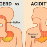 Acidity vs GERD comparison