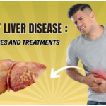 Fatty Liver Disease NAFLD illustration