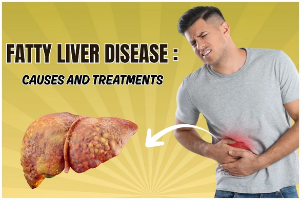 Fatty Liver Disease (NAFLD): Causes, Warning Signs, and What You Can Do